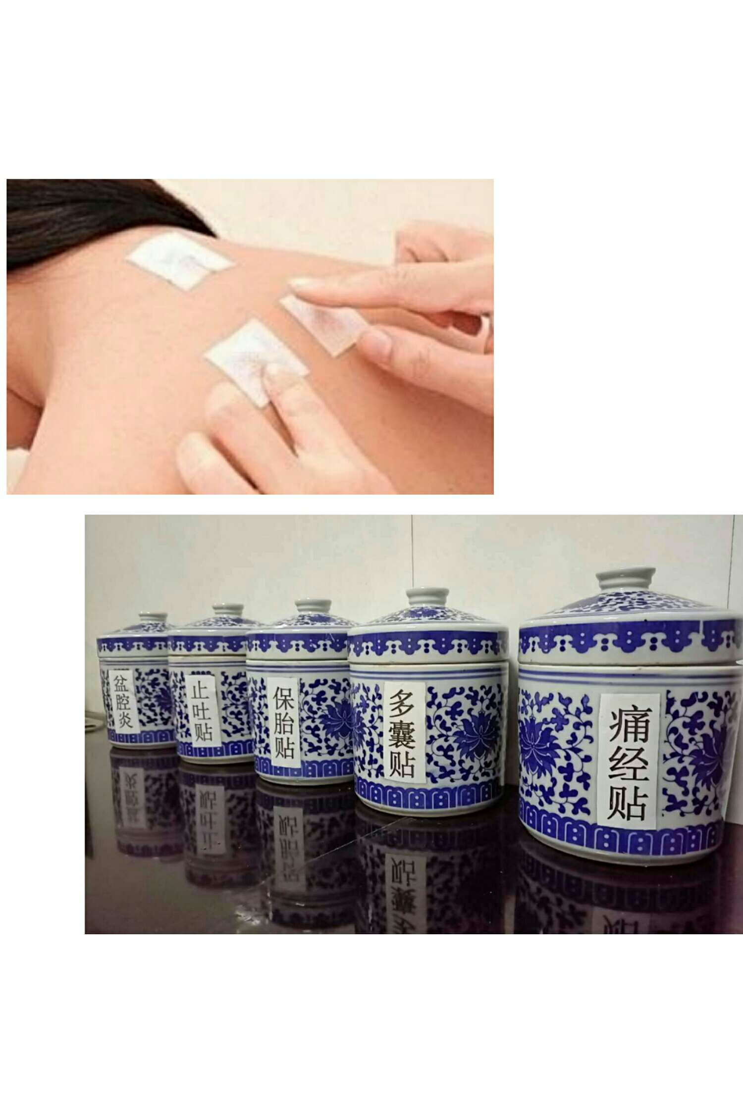 1、三伏貼能治什么?。? style=