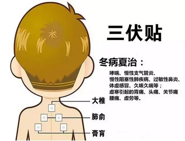 2、三伏貼的功能和功效是什么？
