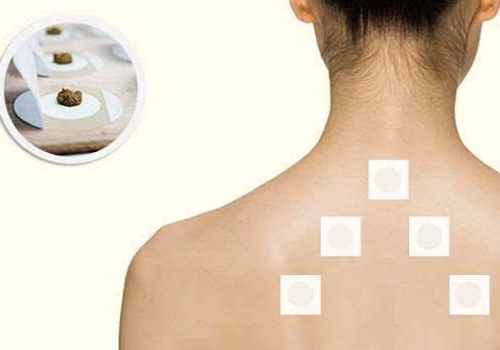 1、誰不適合貼三伏貼？