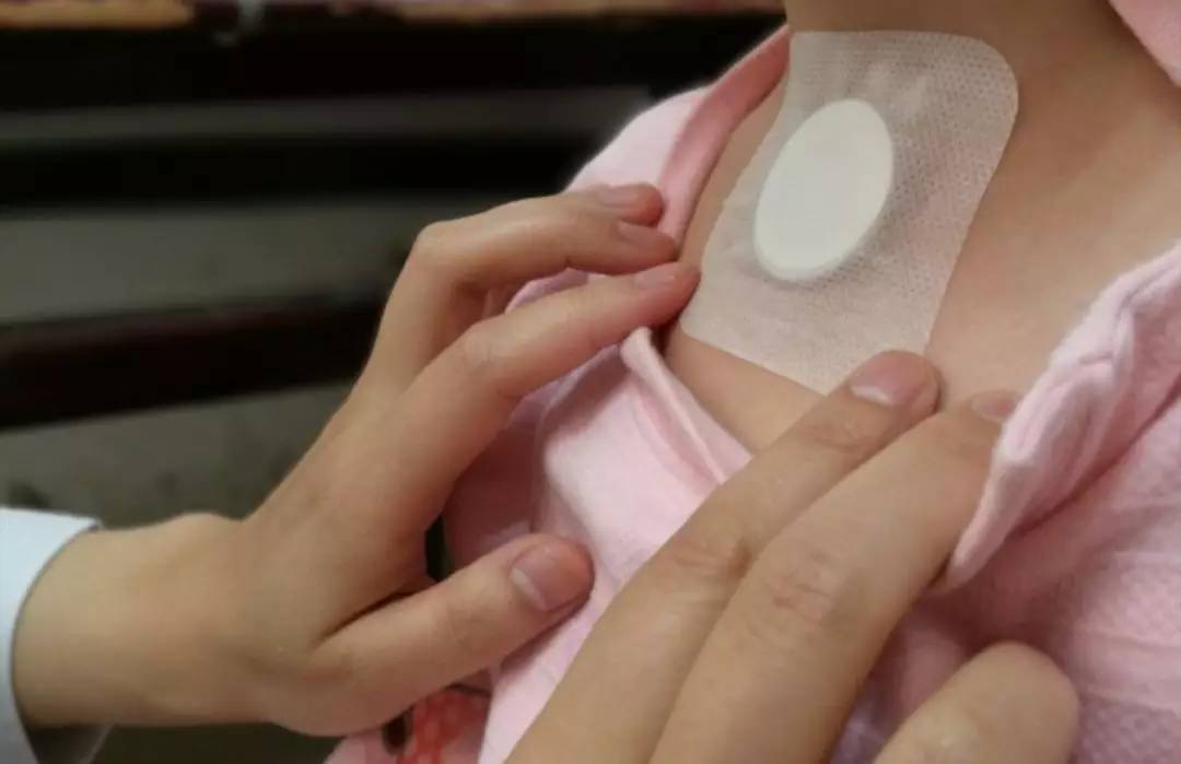 2、三伏貼能排濕嗎？</p><p>女人貼三伏貼有什么好處？