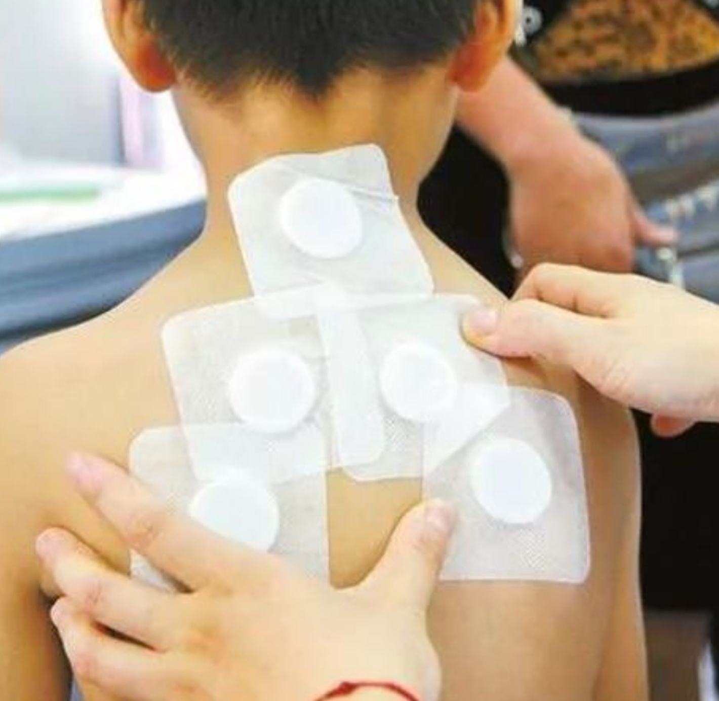 2、三伏貼在脖子上，有一根針，看起來很疼。怎么了